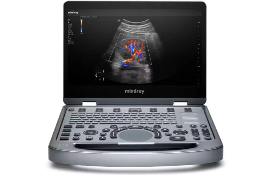 Mindray MX6 — 2