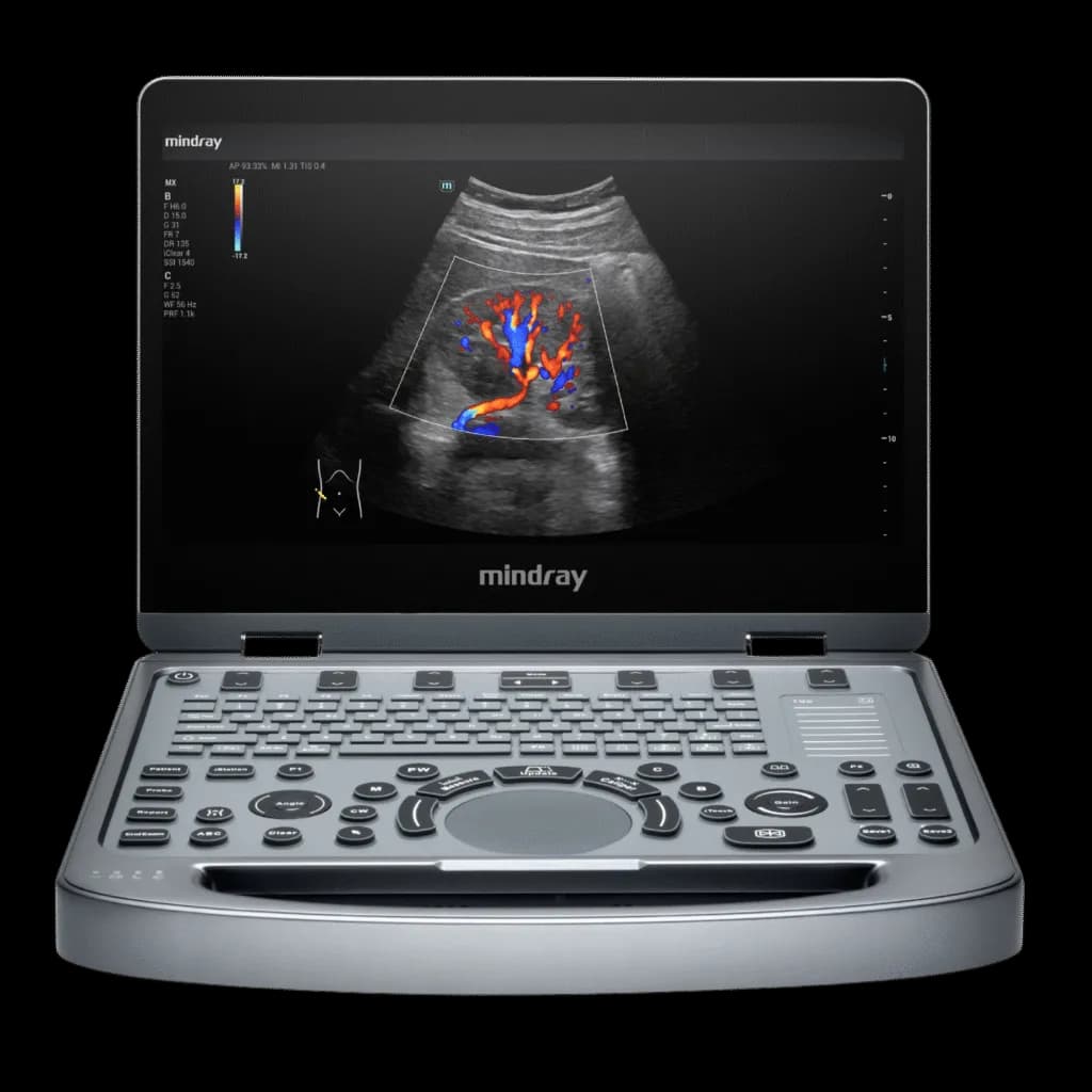 Mindray MX3 — 3