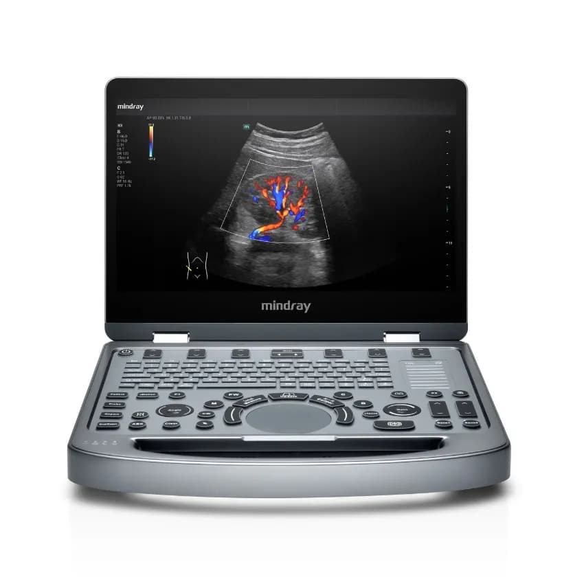 Mindray MX3 — 2