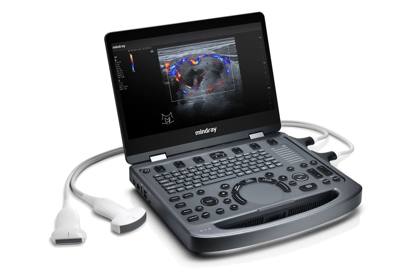 Mindray MX3 — 4